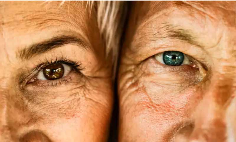Πώς το Αλτσχάιμερ μπορεί να «φανεί» στα μάτια και τι απλό τεστ μπορείς να κάνεις σπίτι